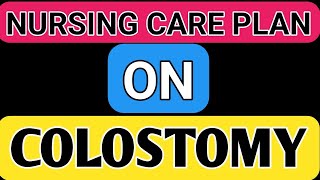 Nursing care plan on ColostomyNCP ON ColostomyCase study on ColostomyAssignment On Colostomy ncp [upl. by Drugge774]