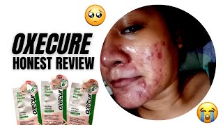 Oxecure honest review by Camille Topacio [upl. by Eva]