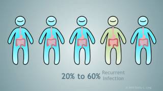 Clostridium Difficile [upl. by Brander184]