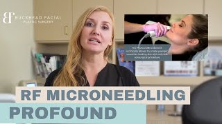 Profound Skin Tightening Treatment Everything you need to know [upl. by Ahsiym]