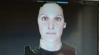 Vectra 3D Imaging System [upl. by Lillie]