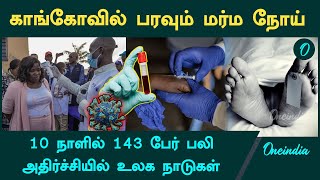 Unknown disease kills 143 in southwest Congo  Oneindia Tamil [upl. by Micaela]