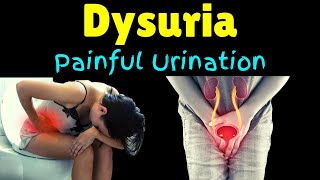 Painful Urination Dysuria Causes and Treatment [upl. by Allemat193]