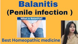 Balanitis  Penis infection treatment  Balanitis symptoms causes amp Homeopathic medicine hindi [upl. by Immak205]