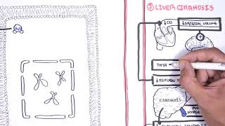 Hyponatraemia Hyponatremia  classification causes pathophysiology treatment [upl. by Amalberga]