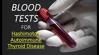 How To Test for Hashimotos Thyroid Disease How Do I Know If I Have Autoimmune Thyroid Disease [upl. by Anitnauq]