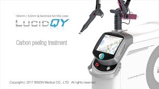 Carbon peeling treatment with LUCID QY [upl. by Piegari]