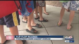 Experts warn against wearing flipflops every day [upl. by Manheim]