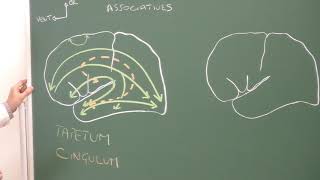 Neuroanatomie 9 substance blanche cérébrale ventricules latéraux Lateral ventricles [upl. by Ynohtnacram312]