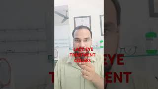 Lazy eye treatment  Lazy eye couses DIPLOPIA HINDI [upl. by Gaulin]