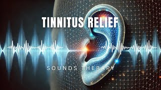 The Most Powerful Tinnitus Sound Therapy  Tinnitus Frequency  Tinnitus Cure [upl. by Shelah372]