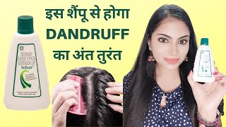 Selsun shampoo for dandruff  Selsun shampoo review  Best antidandruff shampoo review [upl. by Yrot]