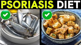 Psoriasis Treatment and Diet Foods to Eat and Avoid [upl. by Aleksandr657]