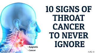 10 Signs of Throat Cancer to Never Ignore [upl. by Airdnal]