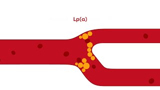 What is Lipoprotein a [upl. by Bevus415]