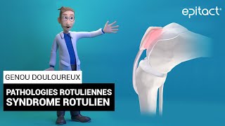 Syndrome Rotulien  Explication  EPITACT [upl. by Solly]