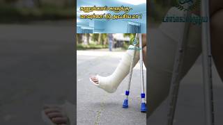 கணுக்கால் சுளுக்கு  மாவுக்கட்டு அவசியமா  Plaster in Ankle sprain Ankle sprain treatment in tamil [upl. by Riorsson335]