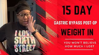 15 Day Gastric Bypass PostOp WeightIn  You won’t believe how much I lost [upl. by Black628]