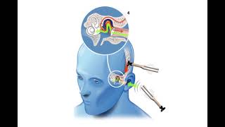 ¿Qué es una audiometria tonal [upl. by Htur]