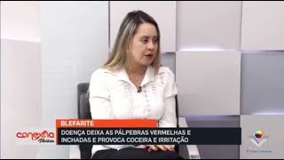 Blefarite infecção das pálpebras  Dra Priscila Naves part Conexão Vitoriosa [upl. by Eidna]