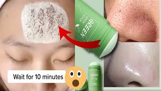 Green Mask Stick Review In Urdugreen stick maskGreen MaskShocking result 😱shortsmuskanstutorials [upl. by Enneirb473]