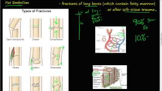 61P  Fat Embolism [upl. by Assital]