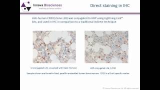 Immunohistochemistry Webinar An Introduction to Immunohistochemistry [upl. by Hathcock279]