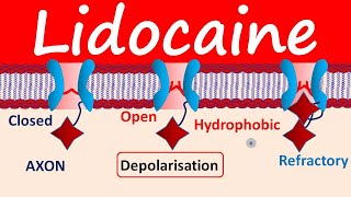 Lidocaine as Local Anesthetic [upl. by Opiak]