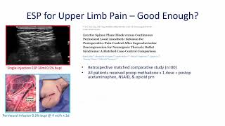 Erector Spinae Plane ESP Block for Upper Limb Pain [upl. by Oicneserc900]