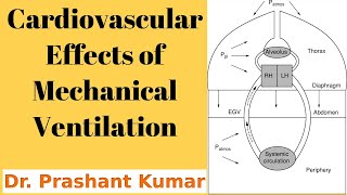 Cardiovascular Effects of Mechanical Ventilation [upl. by Marie-Jeanne]