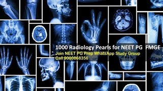 4 PM Quick Radiology 1000 Sure Shot Image MCQs in NEET PG 2020 Call 9000868356 [upl. by Callum]