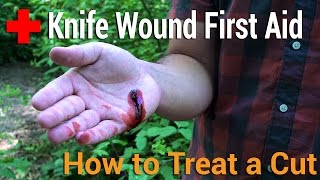 How to Treat a Cut  Knife Wound First Aid [upl. by Yelsiap]