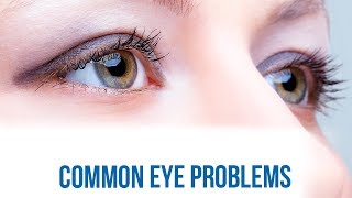 Common Eye Problems hindi [upl. by Dimond794]