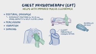 chest physiotherapy amp Postural drainage positions [upl. by Ruder]