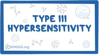 Type III hypersensitivity immune complex mediated  causes symptoms amp pathology [upl. by Hsemar606]