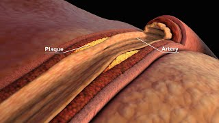 LDL and HDL Cholesterol  Good and Bad Cholesterol  Nucleus Health [upl. by Elyrpa487]