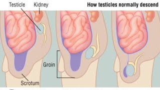 Descend of the Testes Normal Part 02  2nd Year MBBS OSPE [upl. by Eirhtug]