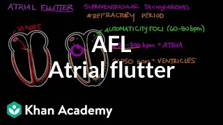 Atrial flutter AFL  Circulatory System and Disease  NCLEXRN  Khan Academy [upl. by Alram418]