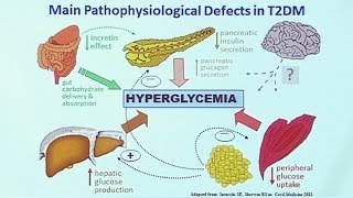 Making Sense of Diabetic Medications [upl. by Milissa164]