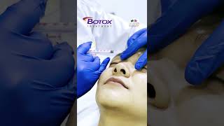 💉Botox for antiaging treatment [upl. by Odinevneib]