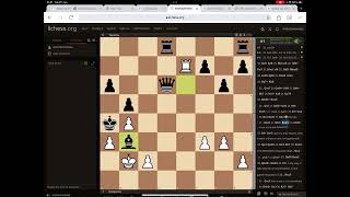 garry kasparovs best immortal game chess [upl. by Harutek870]