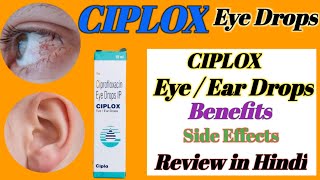 Ciplox Eye  Ear Drops Review in hindi  Ciplox Eye Drops benefitsside effecthealth [upl. by Naasar440]