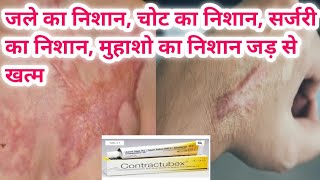 contractubex gel का use चोट निशान जले का निशान ओर किसी भी प्रकार के निशान को जड़ से खत्म [upl. by Witte940]