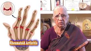 Rheumatoid Arthritis Pain Relief  Reiki and Sujok Acupuncture  Dr P S Lalitha [upl. by Teodoro]