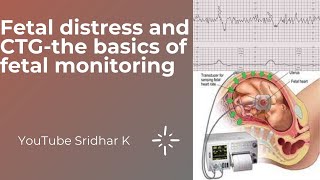 Monitoring for fetal distress CTG monitoring How do we decide action based on CTG Dr Sridhar K [upl. by Lisha]