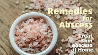 Home Remedies for Abscess  3 Safe Ways to Treat Skin Abscess at home [upl. by Eastman]