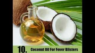 12 Home Remedies For Fever Blisters [upl. by Yelkrab598]