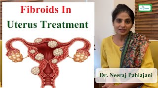 बच्चेदानी में गठान के लक्षण और ऑपरेशन करे या नहीं  Fibroid In Pregnancy [upl. by Adnohr]