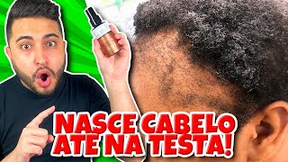 ✅O MELHOR Tônico Capilar para CRESCER cabelo RÁPIDO Antiqueda e ALOPECIAFORTE que MINOXIDIL [upl. by Moses]