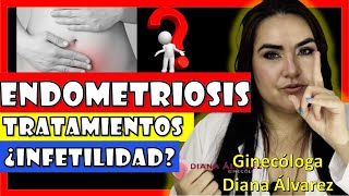 TRATAMiENTO de la ENDOMETRiOSIS por GINECOLOGA DIANA ALVAREZ [upl. by Tabby]